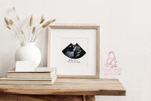 Load image into Gallery viewer, ULTRASOUND BASIC SHAPE - BABY SCAN PRINT- FRAME- PREGNANCY - GIFT