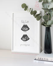 Load image into Gallery viewer, Double Scan - Ultra Sound Art