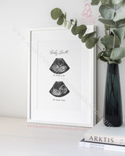 Load image into Gallery viewer, Double Scan - Ultra Sound Art