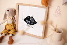 Load image into Gallery viewer, ULTRASOUND BASIC SHAPE - BABY SCAN PRINT- FRAME- PREGNANCY - GIFT