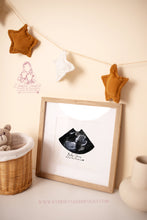 Load image into Gallery viewer, ULTRASOUND BASIC SHAPE - BABY SCAN PRINT- FRAME- PREGNANCY - GIFT