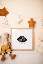 Load image into Gallery viewer, ULTRASOUND BASIC SHAPE - BABY SCAN PRINT- FRAME- PREGNANCY - GIFT