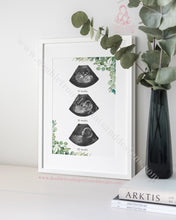 Load image into Gallery viewer, Triple Scan Eucalyptus - Ultra Sound Art