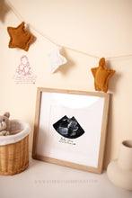 Load image into Gallery viewer, ULTRASOUND BASIC SHAPE - BABY SCAN PRINT- FRAME- PREGNANCY - GIFT
